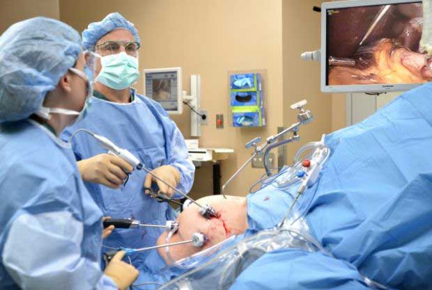 Sleeve Gastrectomy Surgery