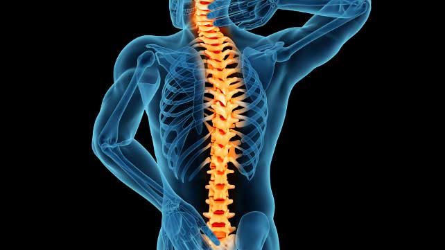 Spinal Stenosis Surgery